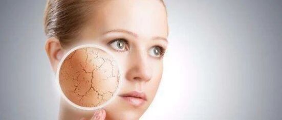 Dry skin counterattack guide | From "desert face" to "reflector", these tips will help you say goodbye to tightness and dandrufs!