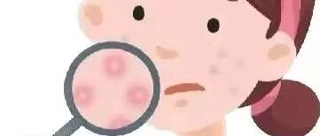 What happens if you don't care for your skin for a long time