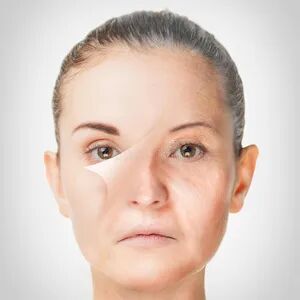 Is your skin aging fast? How to delay skin aging?